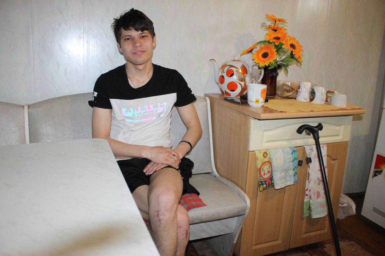 Молодой работник, пострадавший на Серовском ферросплавном заводе, заново учился ходить
