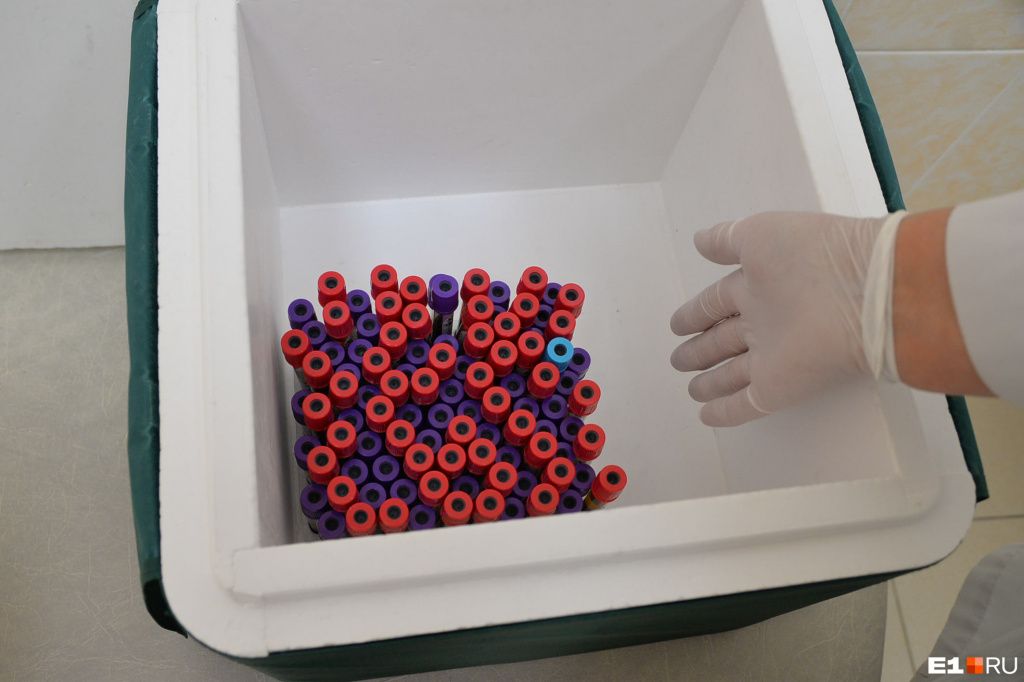 Раз в три месяца пациенты, затронутые ВИЧ, посещают областной Центр СПИДа и проверяют вирусную нагрузку в крови. Фото: Артем Устюжанин / E1.RU