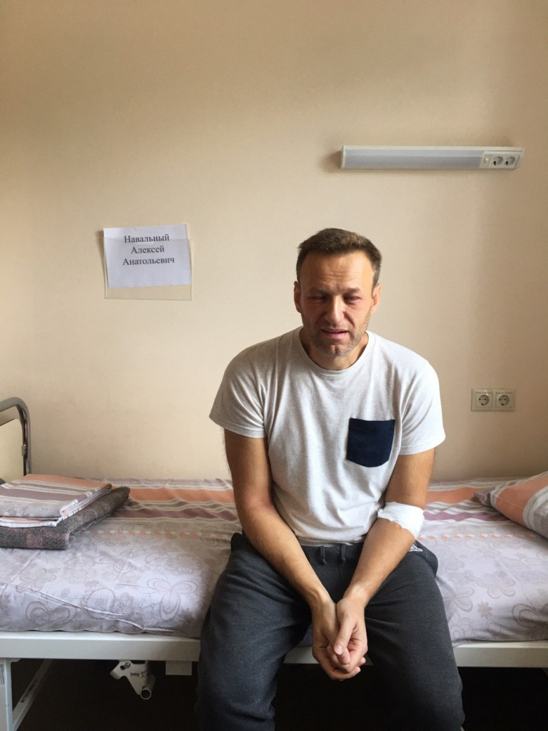 Навальный в палате больницы № 64, когда отек уже начал спадать Навальный в палате больницы № 64, когда отек уже начал спадать
