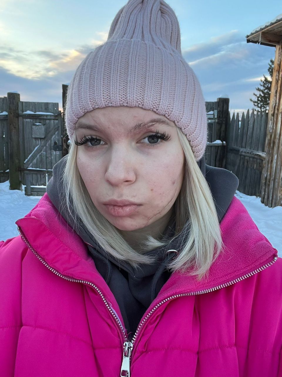 Серовчанку, пострадавшую в ДТП, прооперируют в конце января. На операцию не хватает 230 тысяч рублей