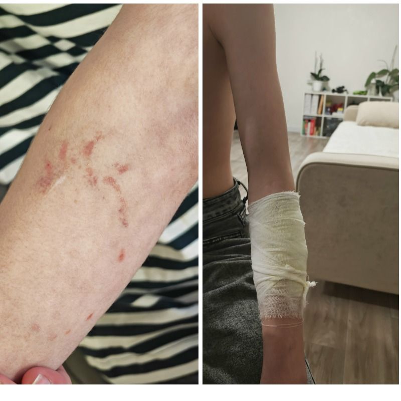 Конфликт между молодежью и серовчанкой закончился ударами поводка и покусанным собакой ребенком