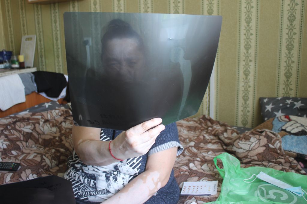 Светлана Михайловна показывает рентгеновский снимок нового сустава. Фото: Мария Чекарова, "Глобус"