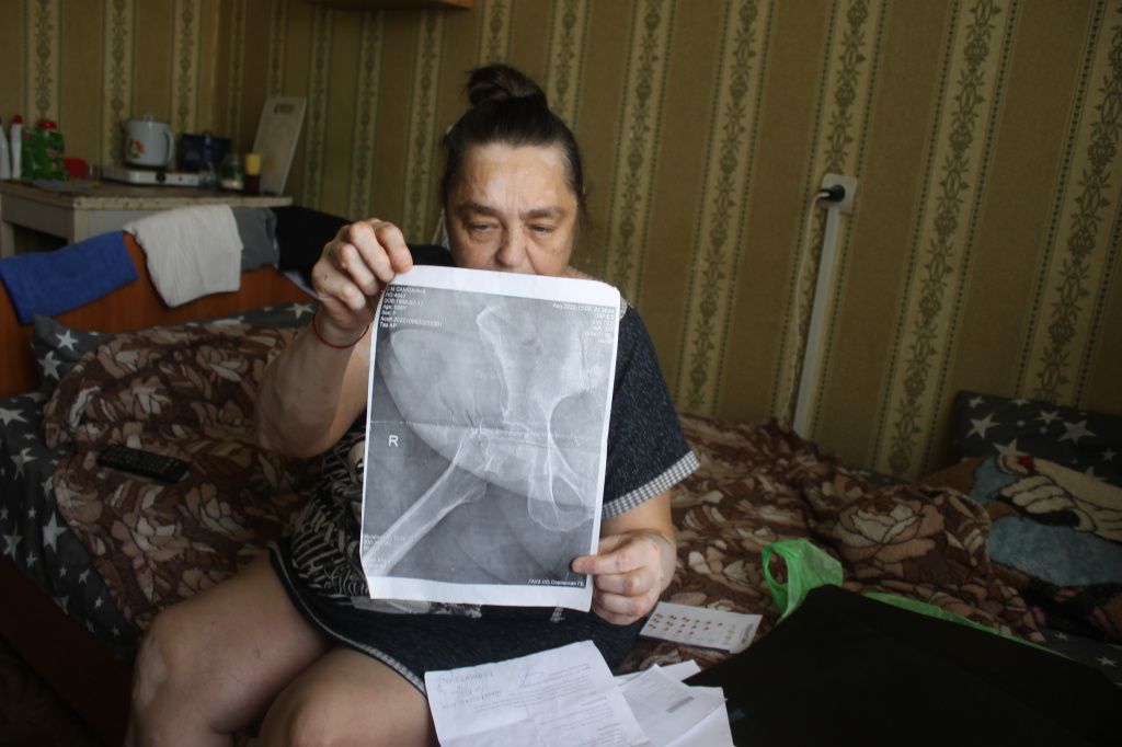 Светлана Самохина показывает снимок перелома тазобедренного сустава. Фото: Мария Чекарова, "Глобус"