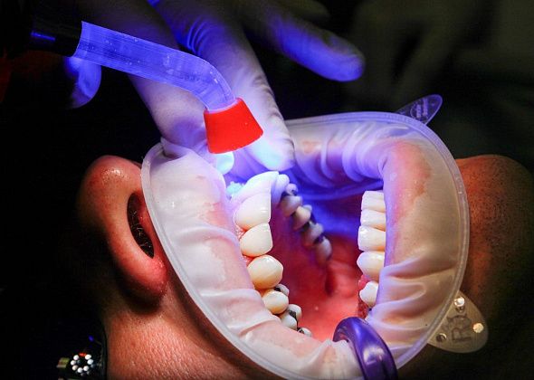 Серовские ветераны боевых действий могут получить материальную помощь на лечение зубов и их протезирование