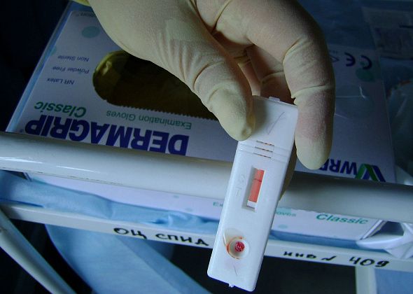 В Северном управленческом округе ВИЧ заражены 7,5 тысяч человек 