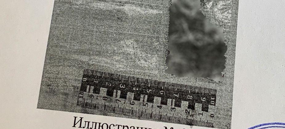 Положительно характеризующийся серовчанин попался на сбыте наркотиков