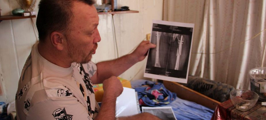 Медики пообещали организовать телемост для серовчанина с переломанными ногами