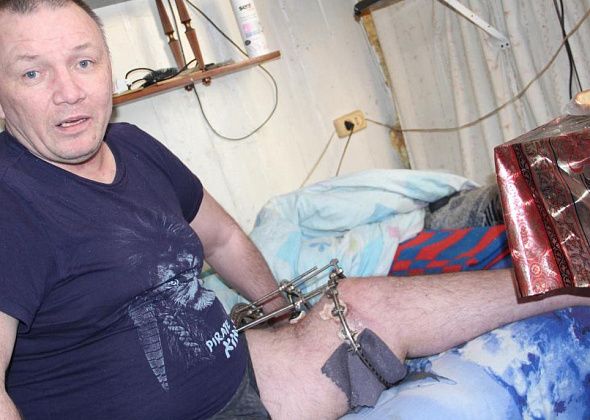 “Я уже не могу: гной, штыри...” Серовчанин два года не может встать на ноги после сложных переломов