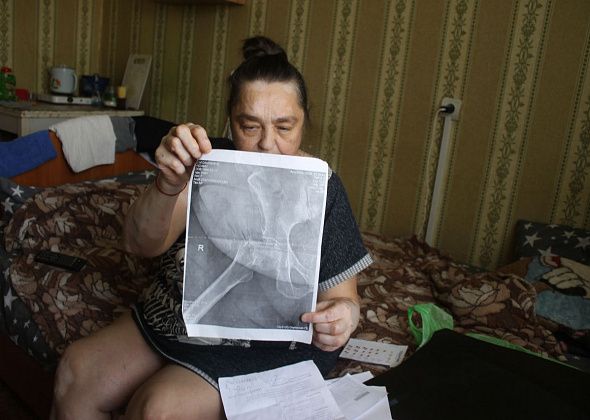 "Сустав у меня болтается". Серовчанка, которая мучается от болей после операции, прошла обследование в Екатеринбурге