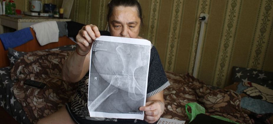"Сустав у меня болтается". Серовчанка, которая мучается от болей после операции, прошла обследование в Екатеринбурге