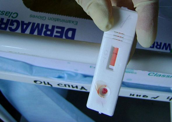 В Серовском горокруге за 10 месяцев выявили 73 ВИЧ-инфицированных 
