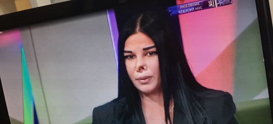 Серовчанка, которой сожитель откусил нос, стала героиней остросоциального ток-шоу