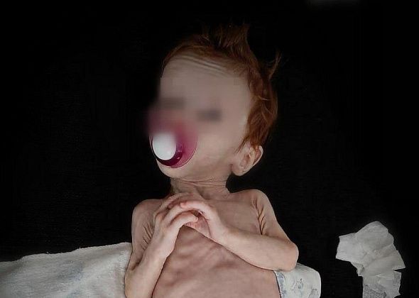 “Сейчас у нее все хорошо”. Девочка, которая была найдена в шкафу в изможденном состоянии, идет на поправку