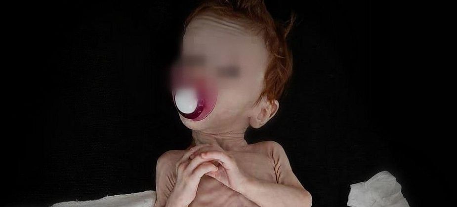 “Сейчас у нее все хорошо”. Девочка, которая была найдена в шкафу в изможденном состоянии, идет на поправку