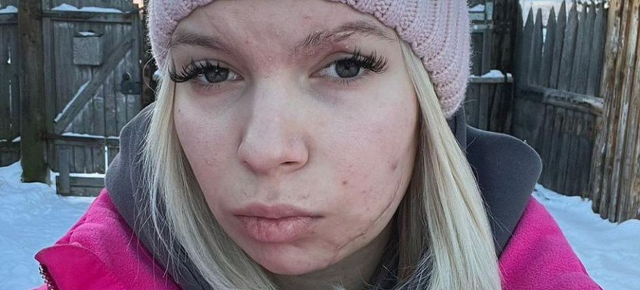 Серовчанку, пострадавшую в ДТП, прооперируют в конце января. На операцию не хватает 230 тысяч рублей